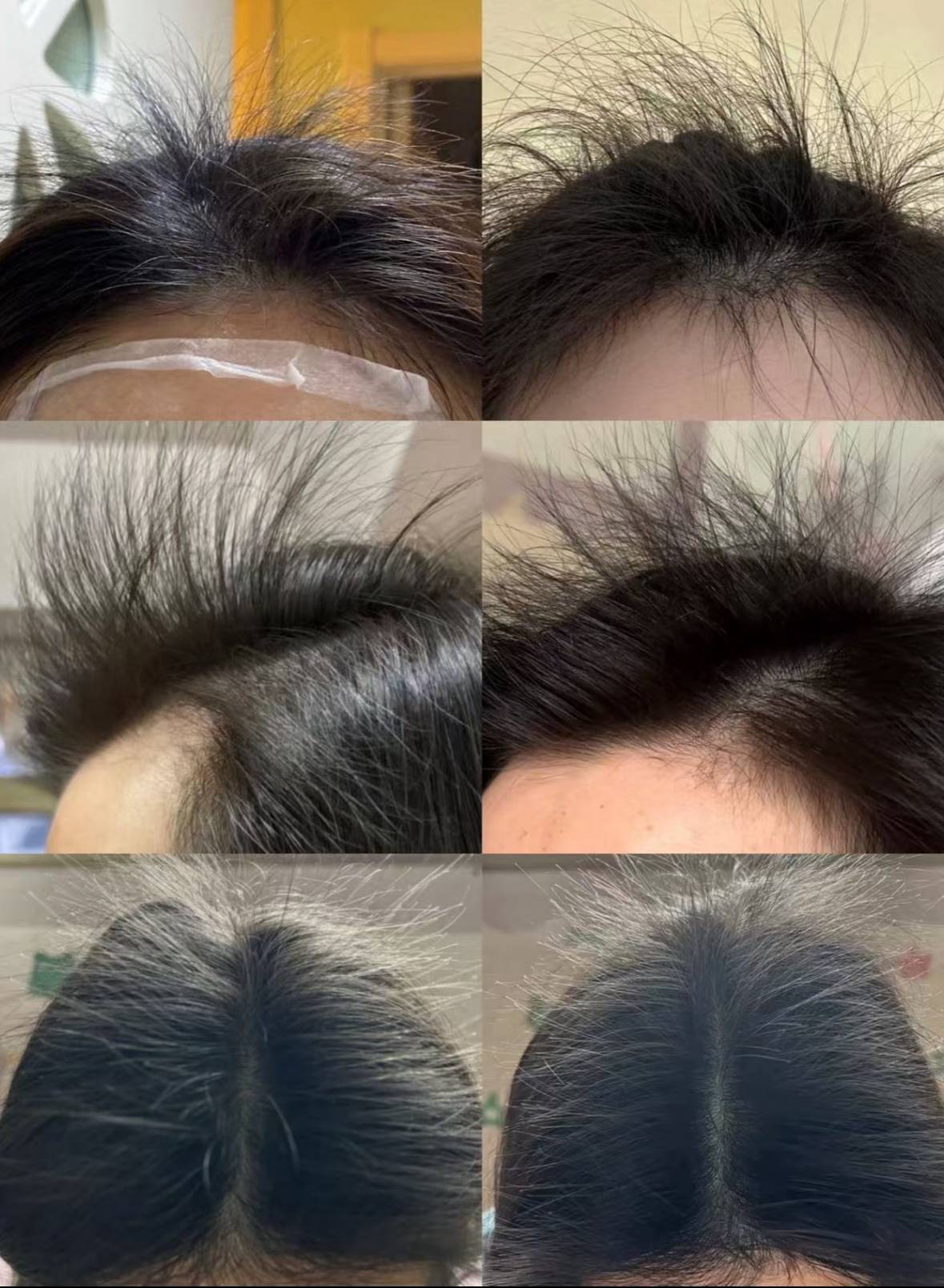 育发液哪个牌子效果最好?国药排名第一的防脱生发产品实力公布