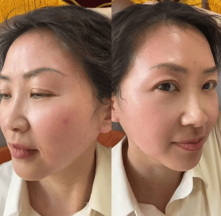 焕瑟祛斑真的那么神奇吗?焕瑟祛斑多少钱一套