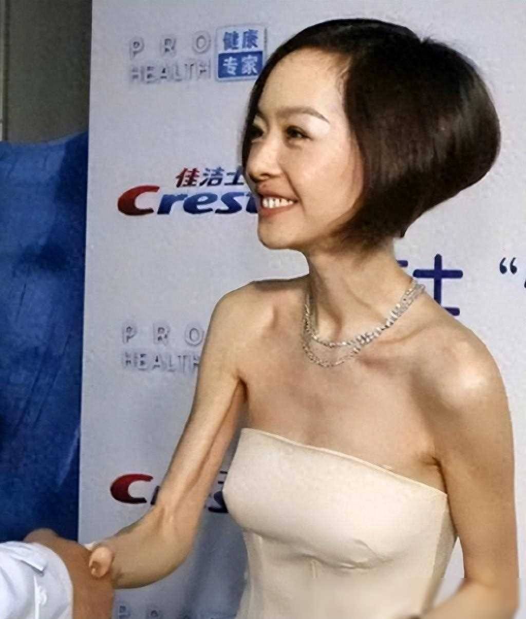 镜头前女神,现实中堪比"女鬼"!这些瘦到脱相的女明星,真辣眼