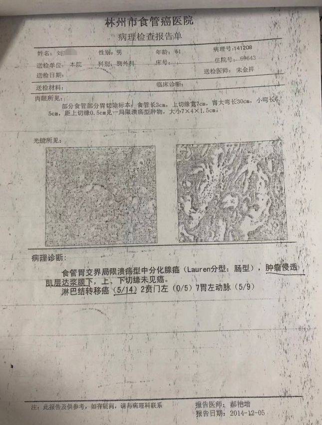 术后病理报告显示:中分化腺癌,并伴有淋巴结转移