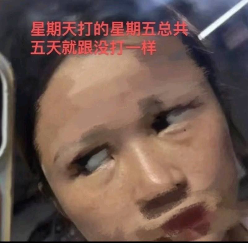 屡遭消费者指控效果差 南昌佳美美容医院问题出在哪儿了?(图4)