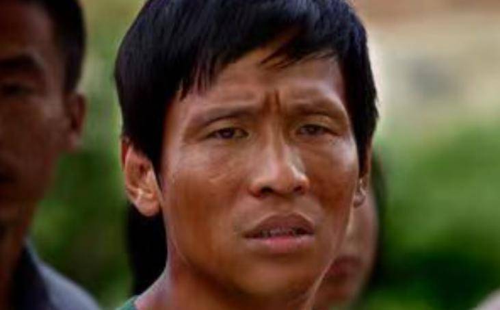 宋小宝为什么那么黑的简单介绍