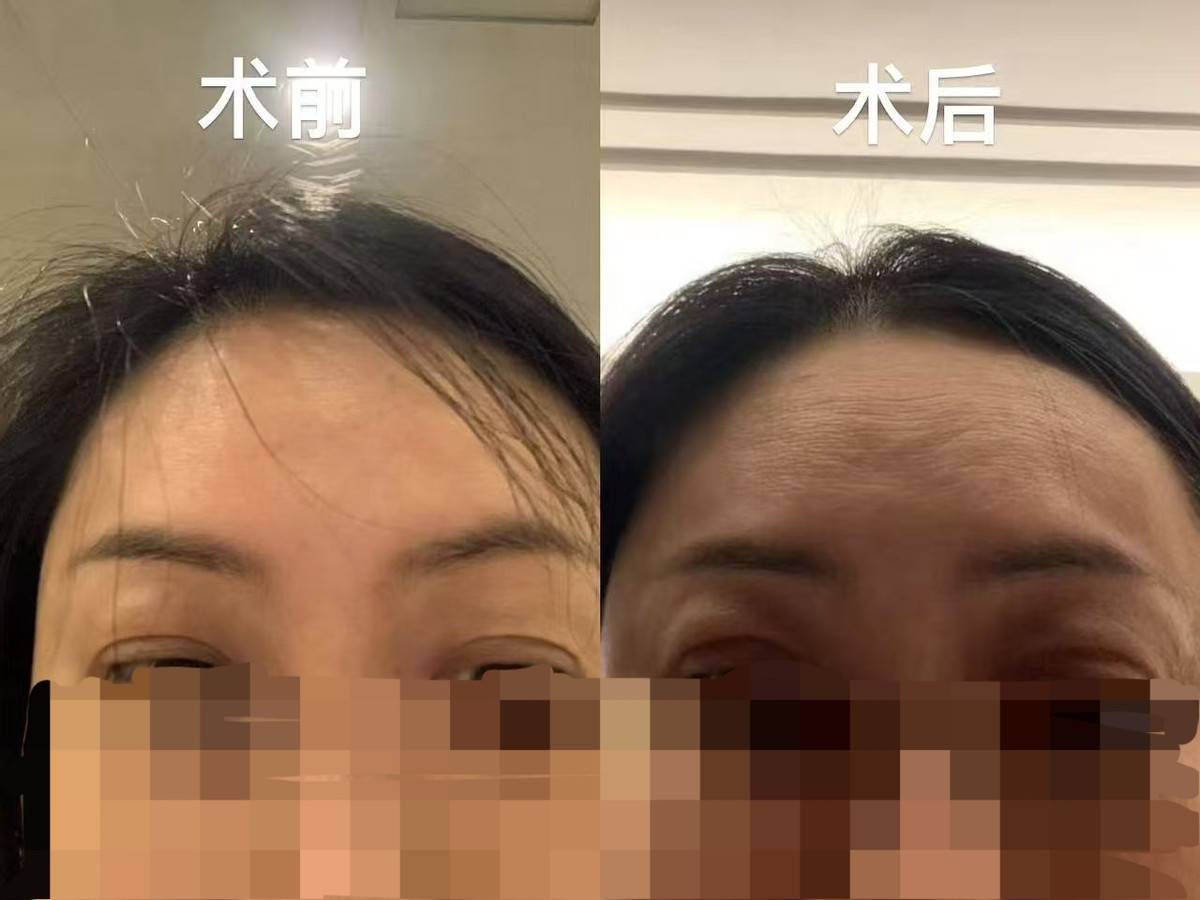 南京睛禧医美爆雷:宣传医师资源丰富实际在保员工仅两人(图3)