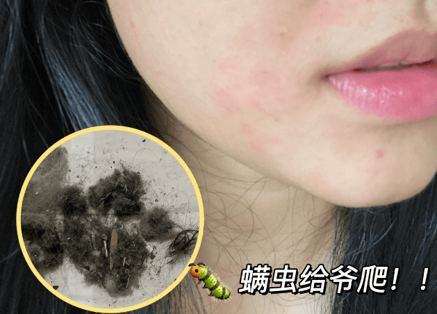 除螨仪哪家比较好？家用除螨仪多大功率合适？十大高口碑除螨仪品牌排行榜！独家测评放送！