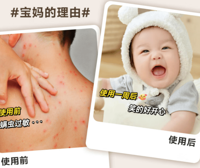 家用除螨仪是否真有用？口碑最好的除螨仪是哪款？十大高质量品牌除螨仪排行榜单揭秘