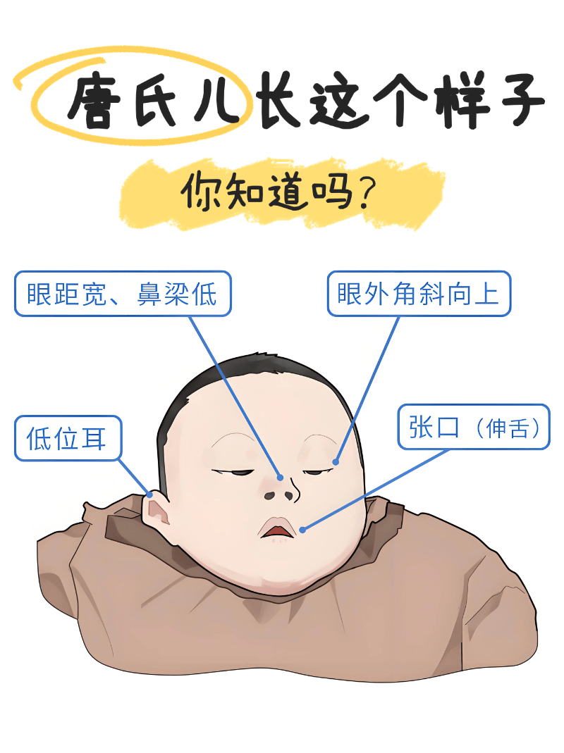 孕妇做B超看到胎宝吐舌头,爸爸:可爱又呆萌!医生:有问题