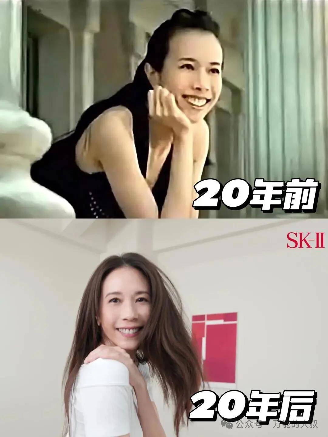 sk-ii