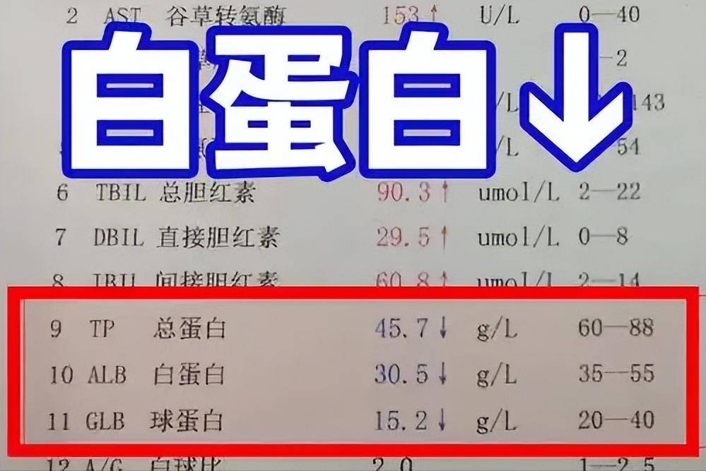 原创            一半中国人蛋白质没吃够！医生：64岁以上人群，每天这样吃才达标