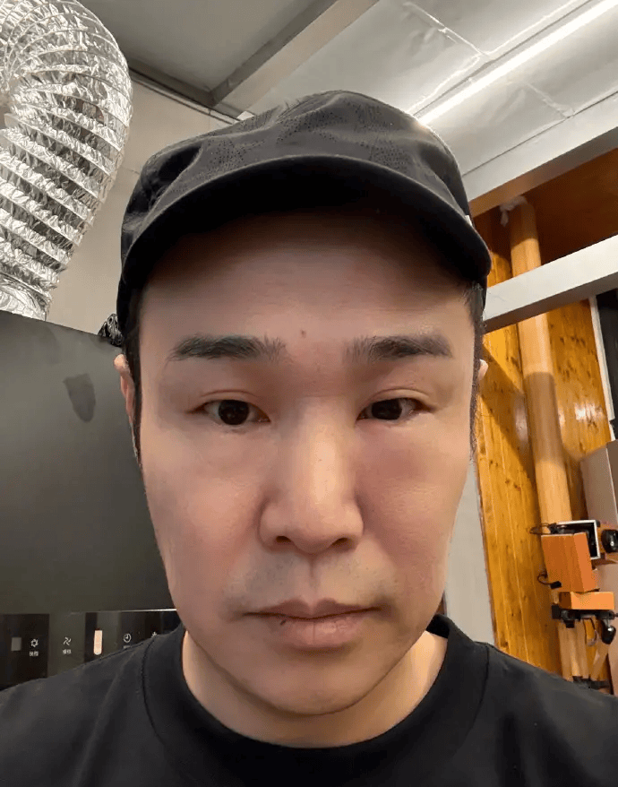 小沈阳晒照称自己眼睛肿了:大家看直播别乐出来就行封面图