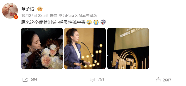 章子怡分享拍戏呼吸性碱中毒经历：情绪大戏后身体麻木需缓解