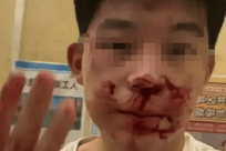 冒充警察殴打高中生，3人认罪