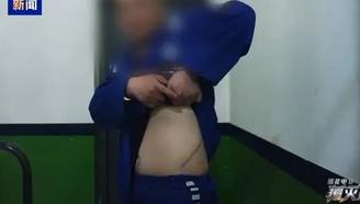 缅北电诈回流者述被割肾：只要能走 锯腿都愿意