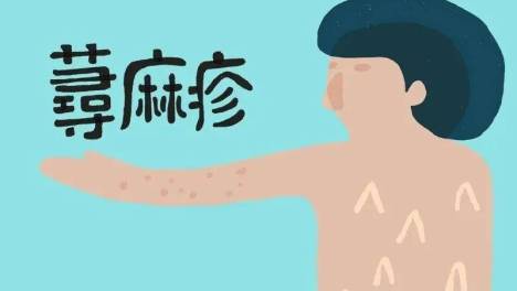 荨麻疹发作的10种原因！4个方法帮你解决问题