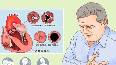 突发房颤，该如何处理与调理