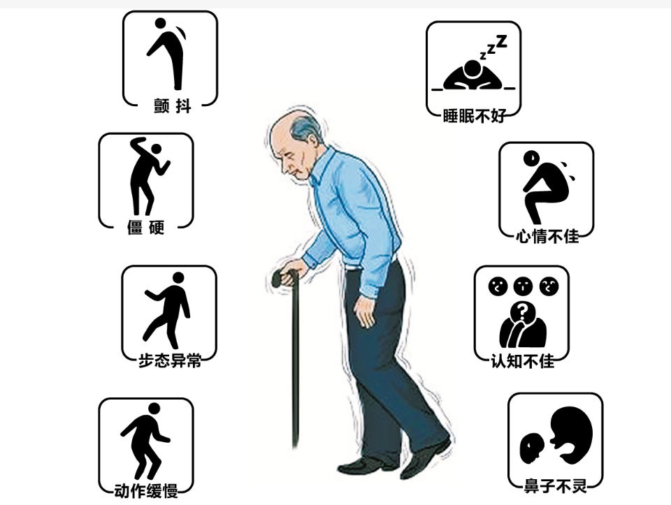 帕金森病中晚期全身僵硬是什么原因_患者_肌肉_治疗