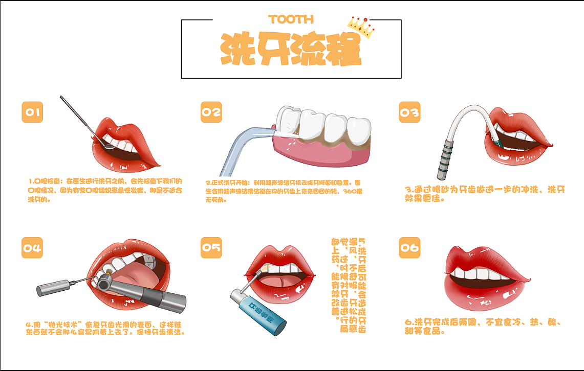 洗牙一般需要多长时间?听听主任怎么说的