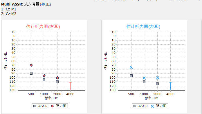 听力测试报告单图片