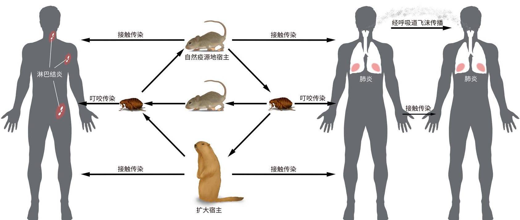 鼠疫__