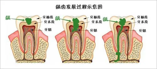 牙齿的结构名称图片