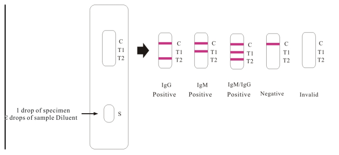 伤寒杆菌igg/igm抗体快速检测卡(金标法)_试剂_结果_颜色