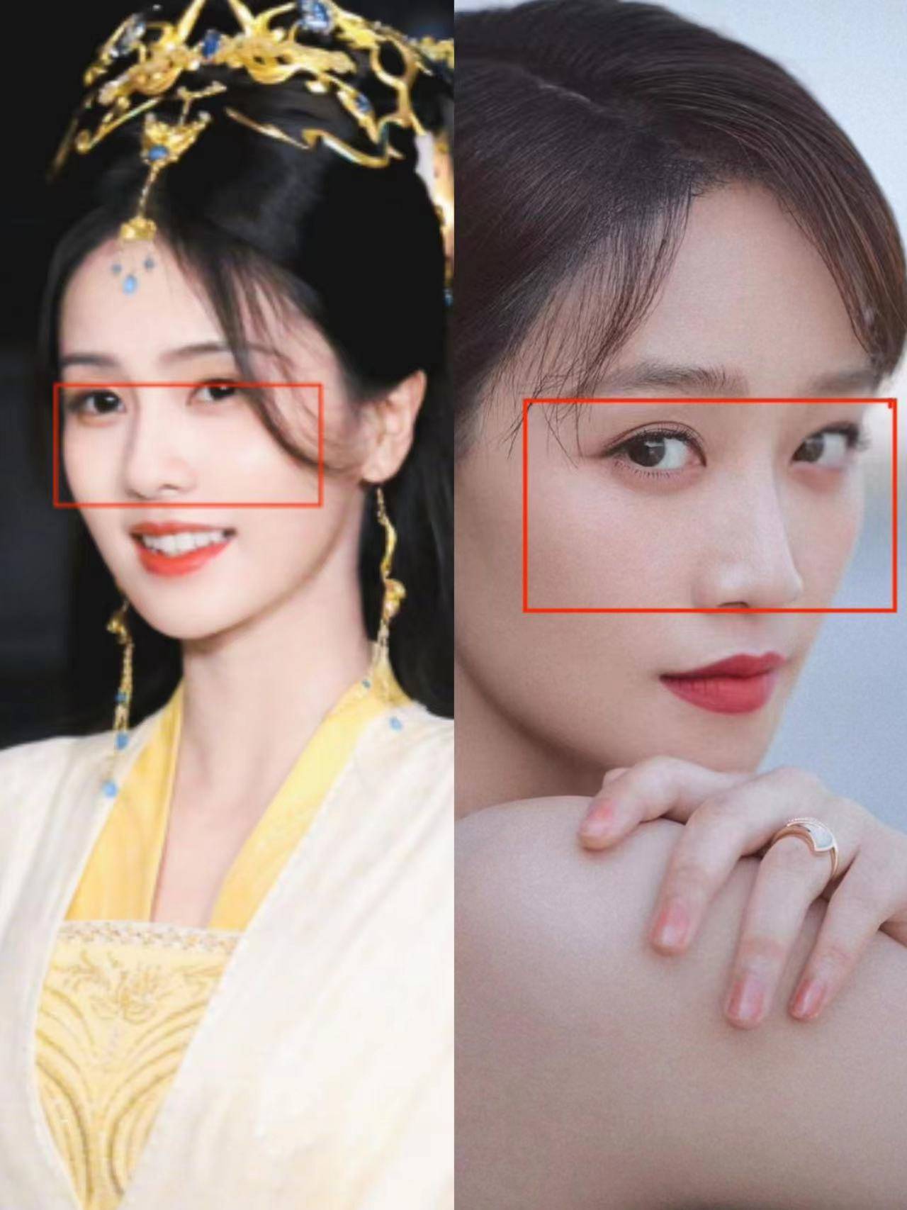 为什么说白鹿的颜值符合当前审美趋势 —adm-h鼻基底填充_自然_面部