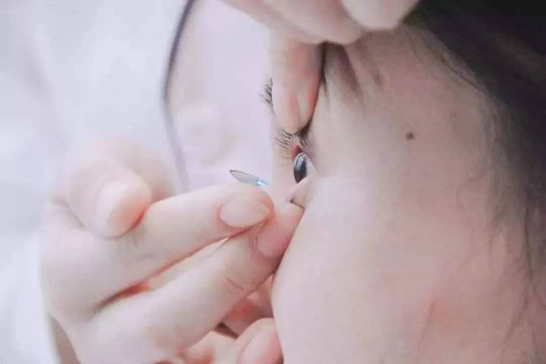 ok镜是什么,多少钱一副?——康晶金眼科