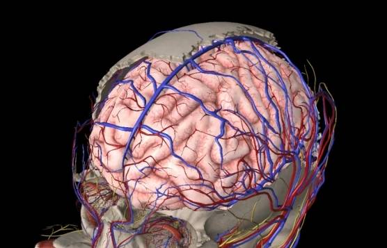 攻克高难度颅内感染的艰难之路 ----记中国医学科学院协和整形外科