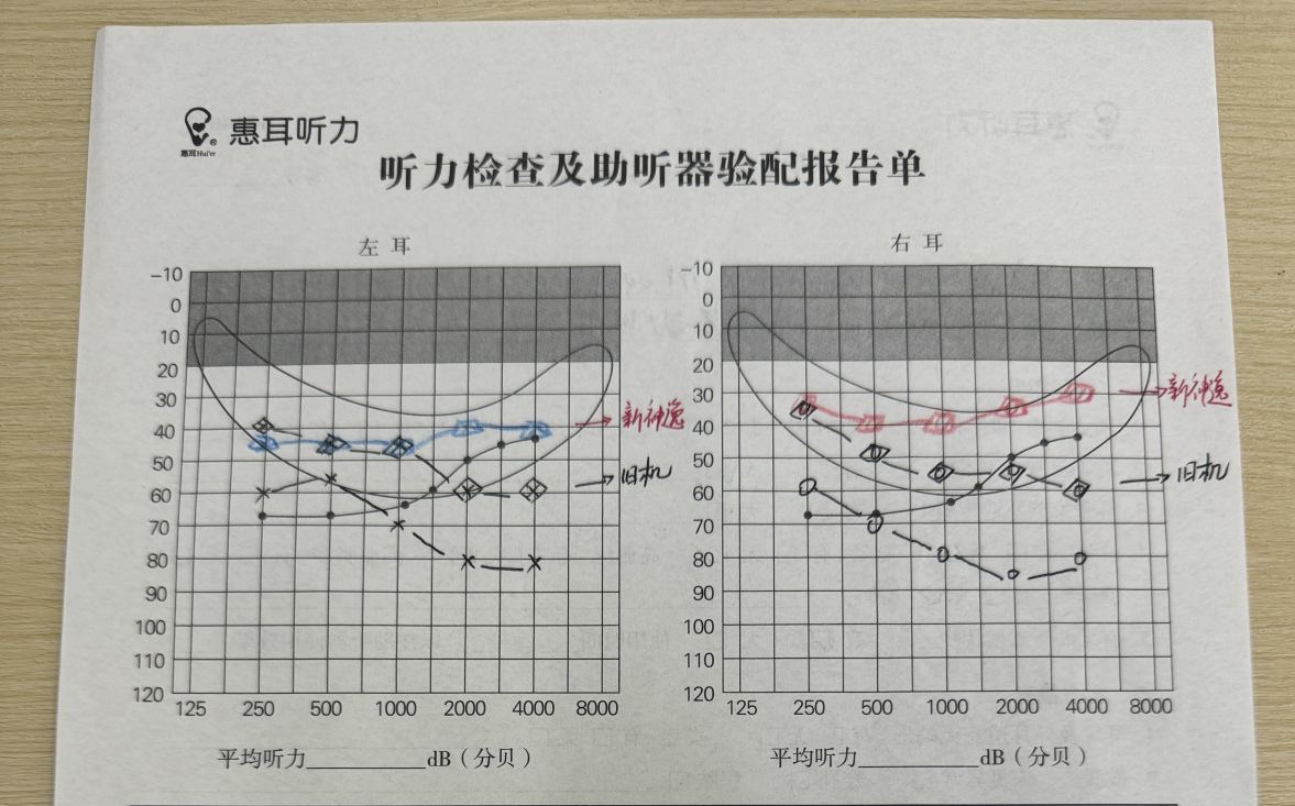 机,唯一的梦想就是佩戴定制机,也经常试听各大厂家品牌助听器进行对比