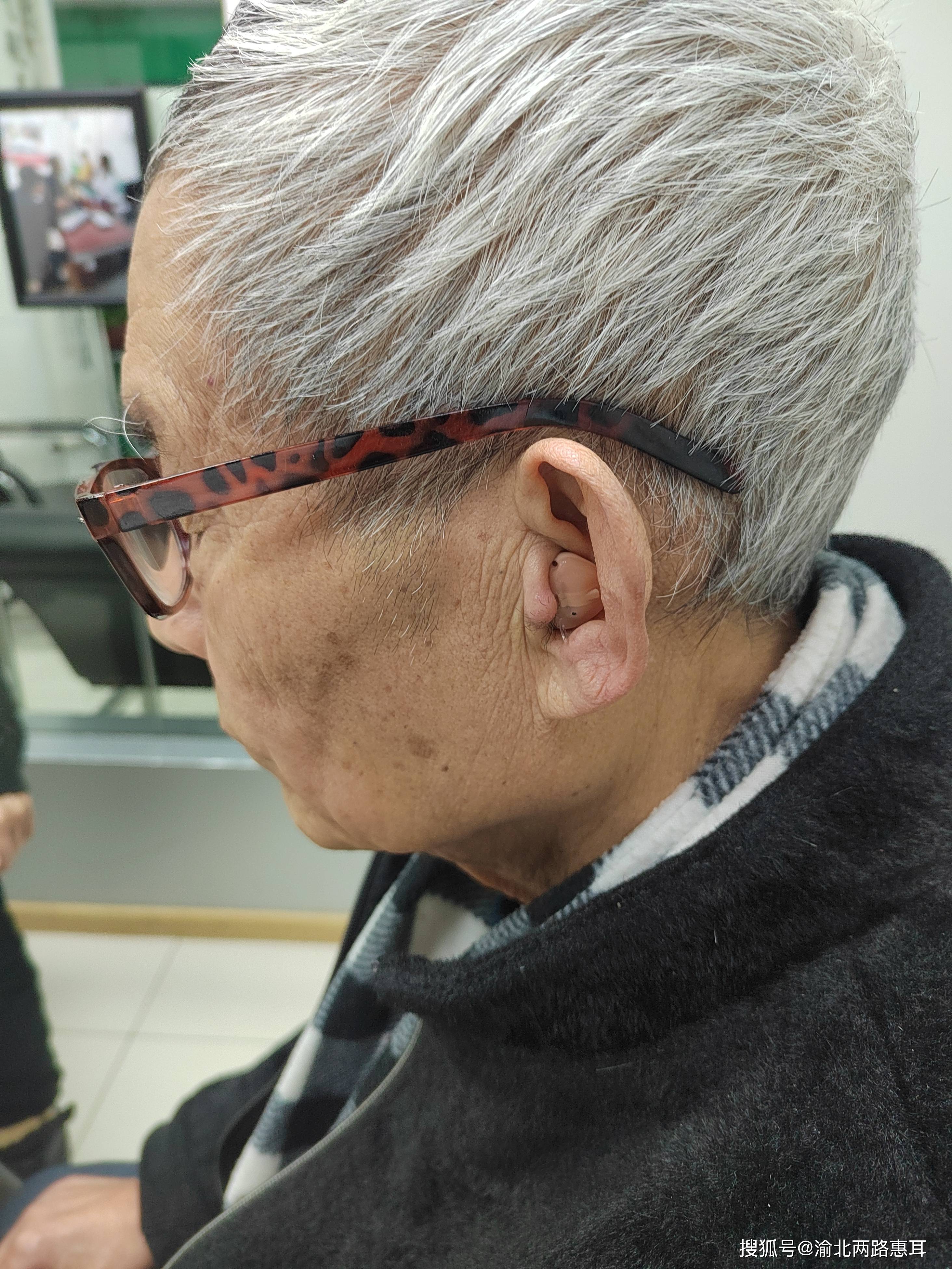 重庆渝北助听器案例分享:听力都这么重了还有必要配助听器吗?