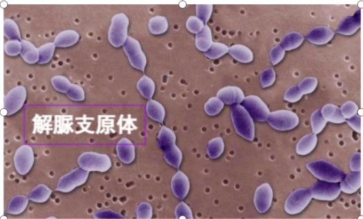 男性解脲支原体阳性会影响生育吗_治疗_症状_能力