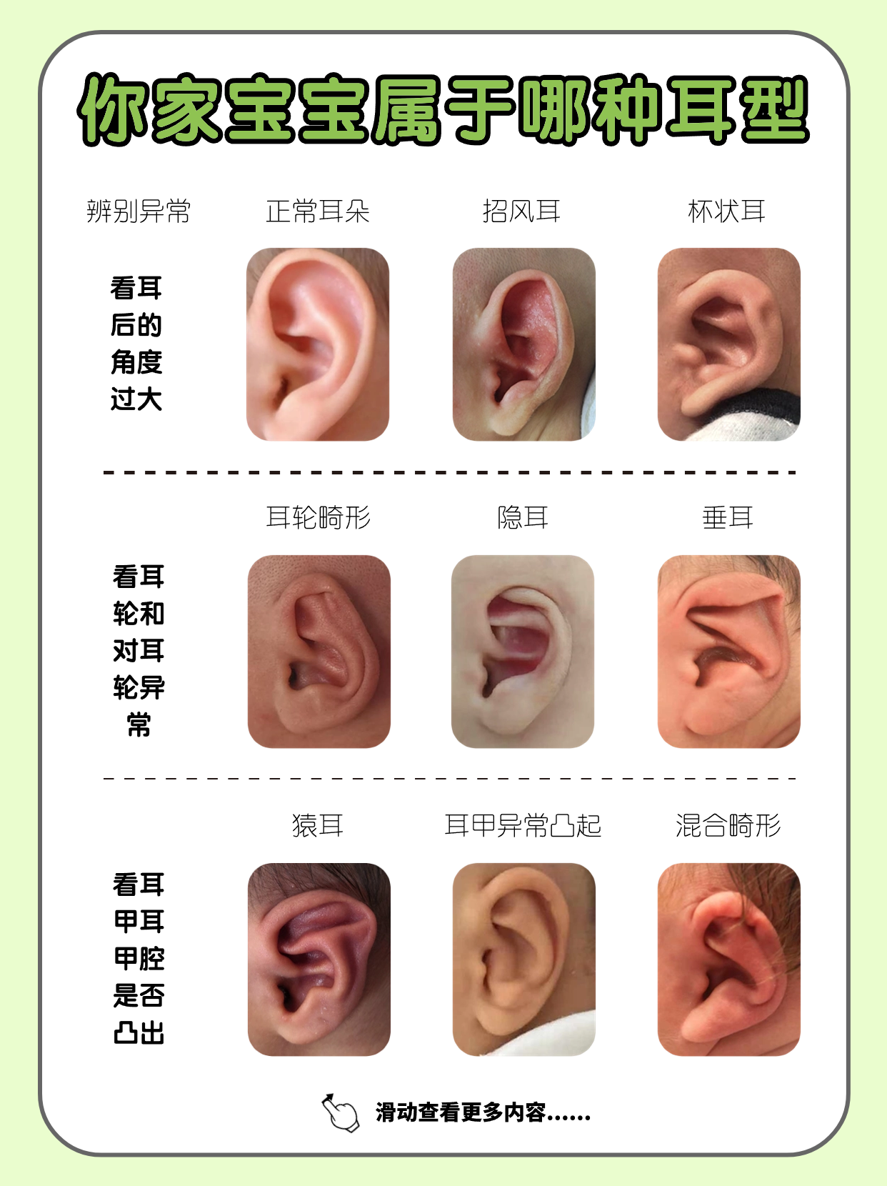 耳朵的类型 种类图片