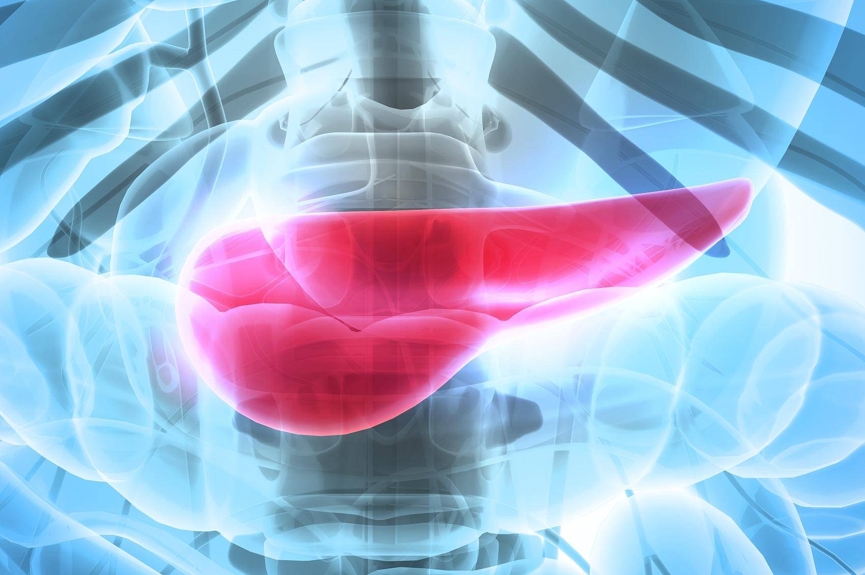 如何警惕胰腺癌?看看这些症状!_患者_恶性肿瘤_诊断