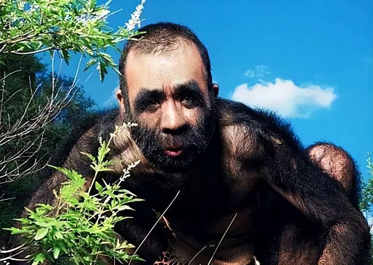 原创当年轰动一时的毛孩42岁娶90后娇妻生下一子未遗传长毛