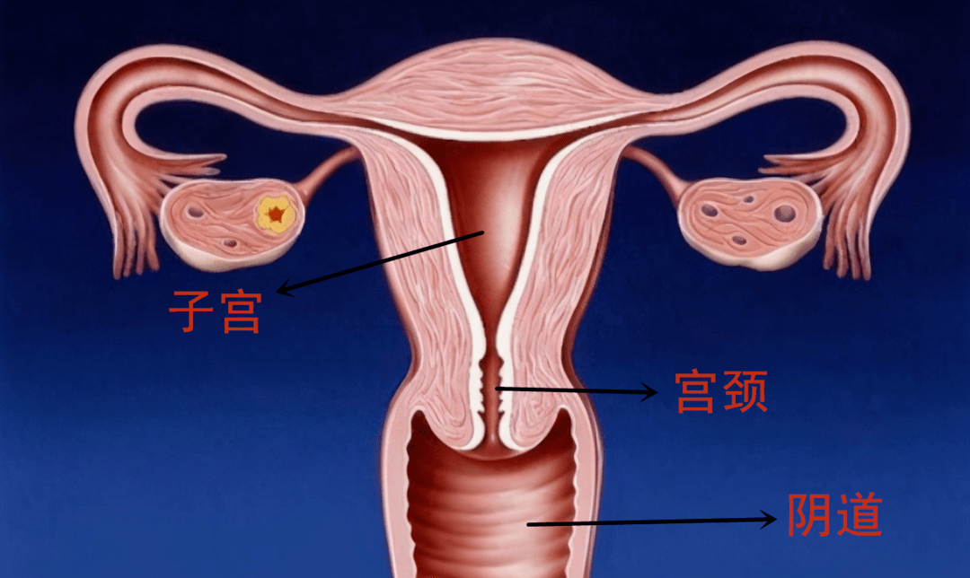 子宫颈长什么样看图片图片