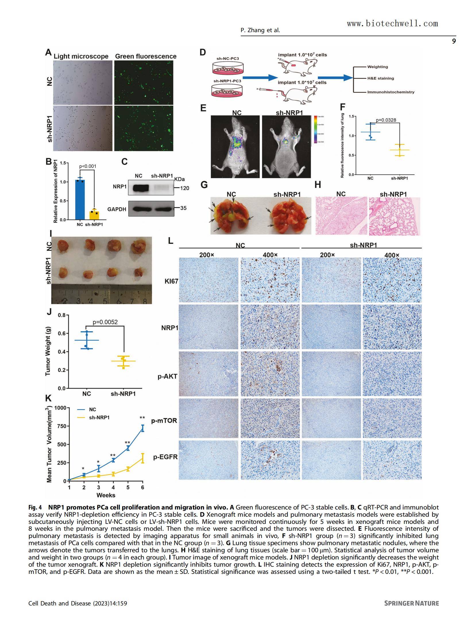 上海威奥前列腺癌组织芯片文献13