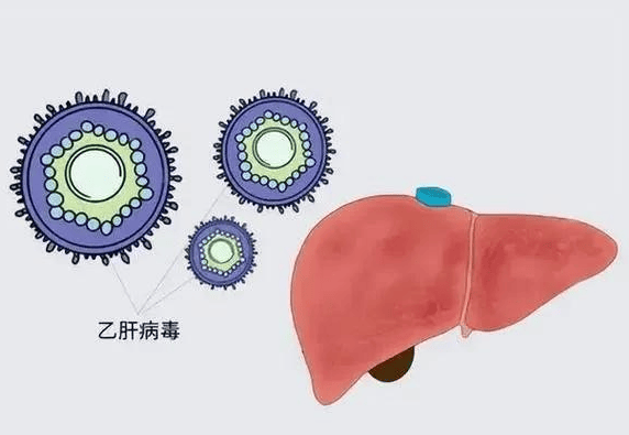 如何诊断乙肝病毒携带者