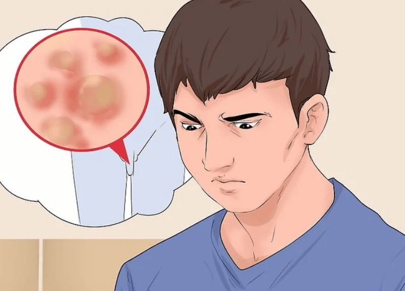 郑州合心性病医院近期很多门诊患者提问:"私处的小疙瘩,小肉芽是尖锐