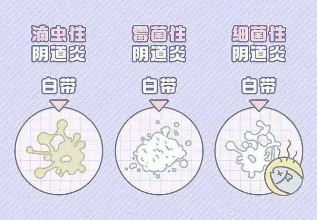 女性__