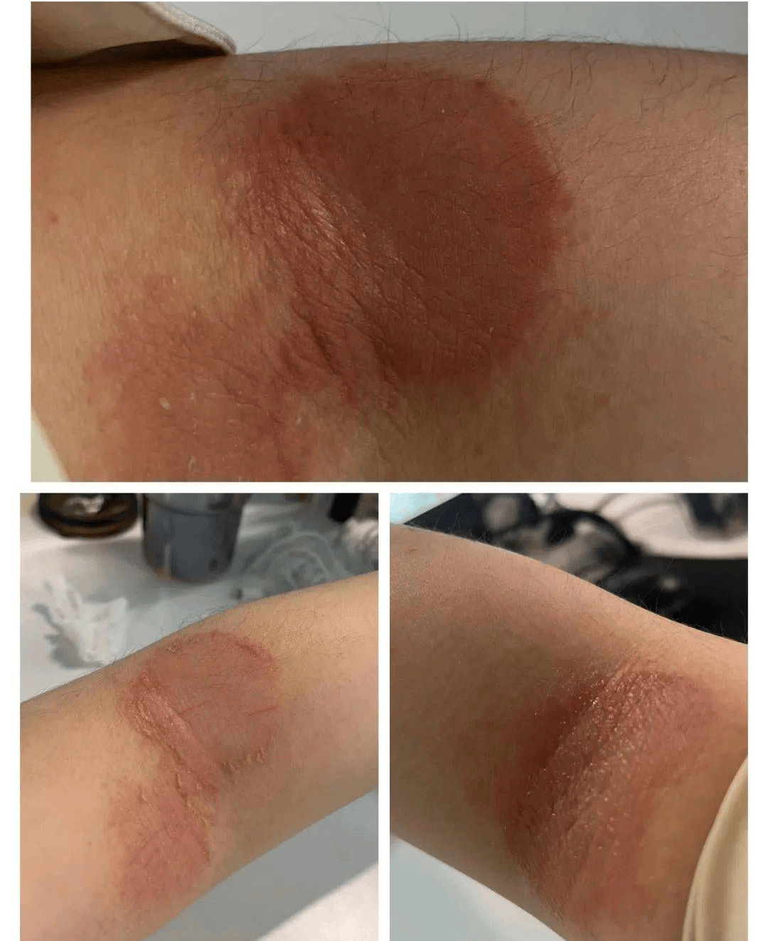 她的婚礼被无限期推迟尽然是因为身上有这些东西