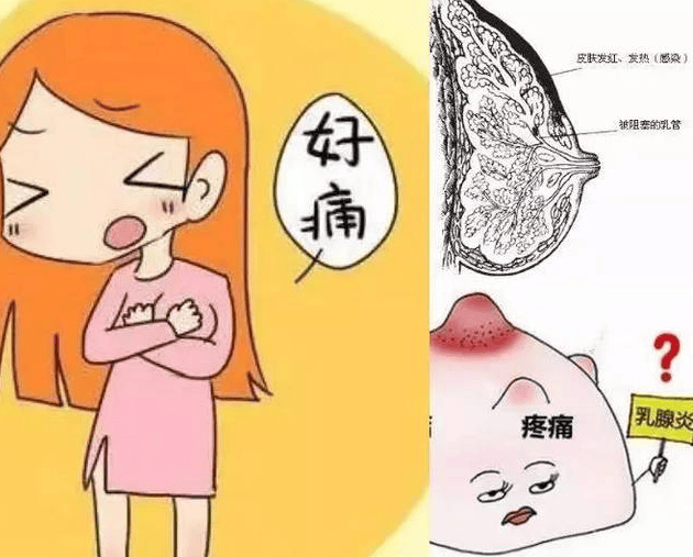 这个哺乳乳腺益生菌,我不允许你们不知道