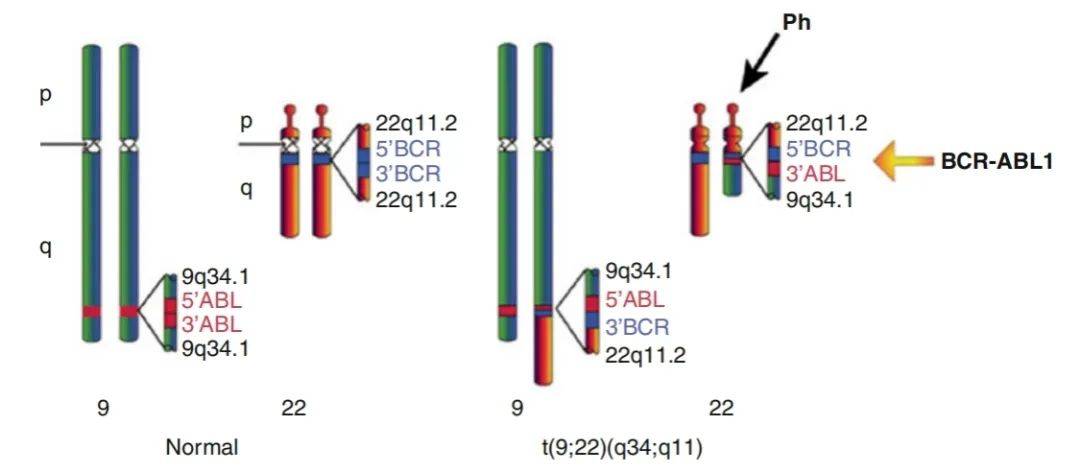 【AmBeed简析】解读BCR-ABL1：从作用机制到抑制剂应用的探索_患者_染色体_基因