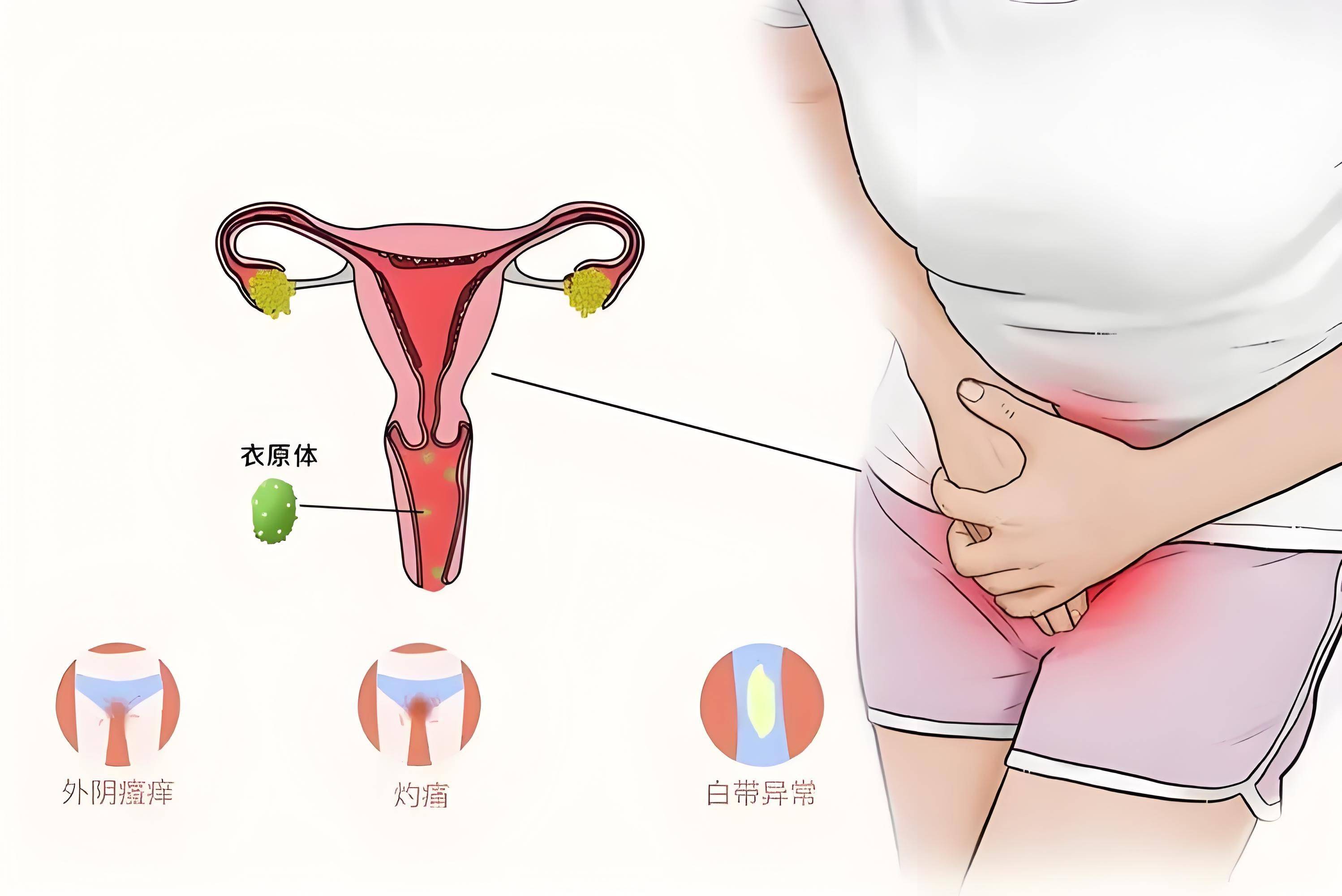 鸽子衣原体的症状图片图片