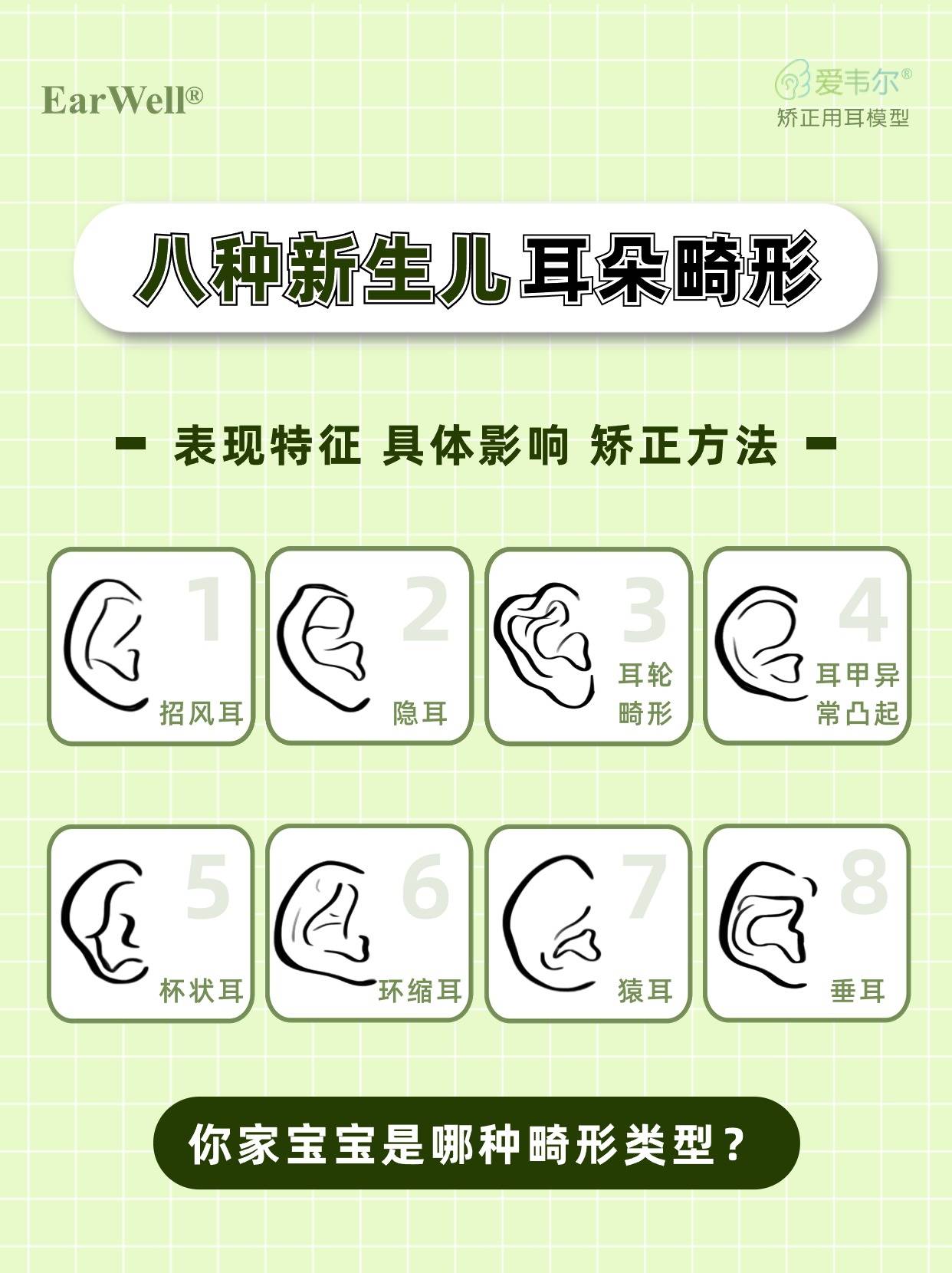 8种新生儿耳朵畸形类型!