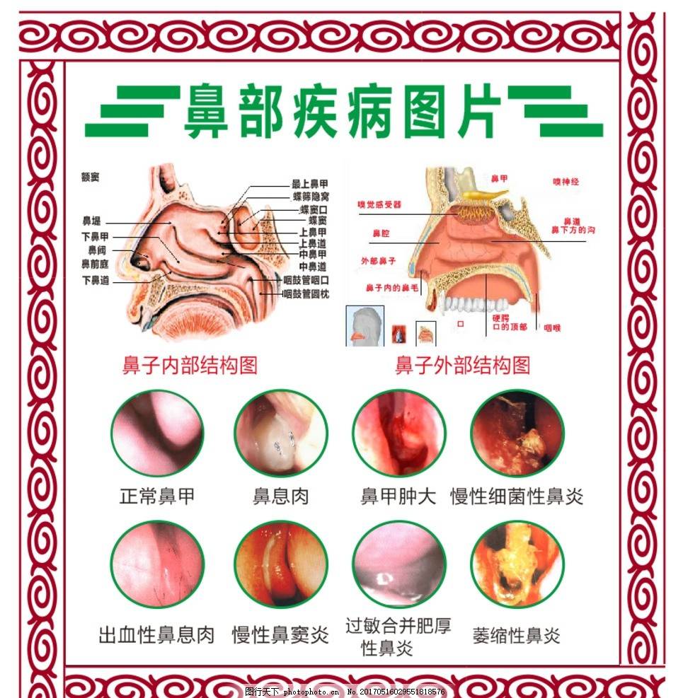 鼻郎中的功效