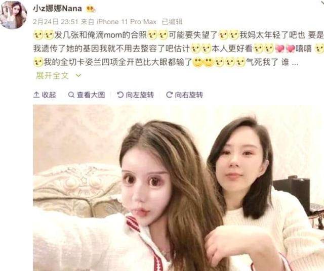 小z娜娜整容后悔图片