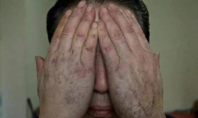 卧底宋名扬:破案染上毒瘾,公安部门为他开证明,如今近况如何?