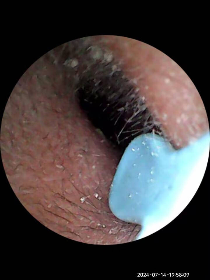 西圣find智能可视耳勺：可视化操作，采耳更安全和快捷