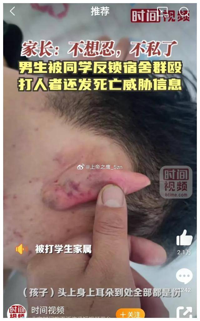 打人哪里最疼却不致命图片