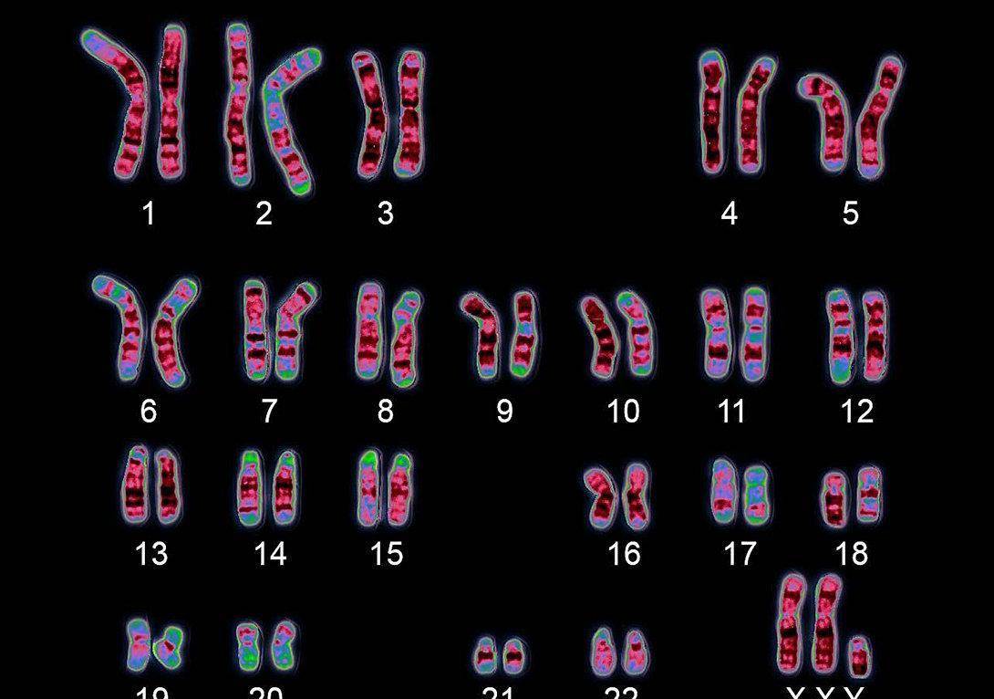 人类染色体图谱图片