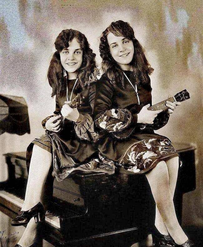 英国连体姐妹:被人当成赚钱工具,姐姐死后,妹妹与遗体共存2天